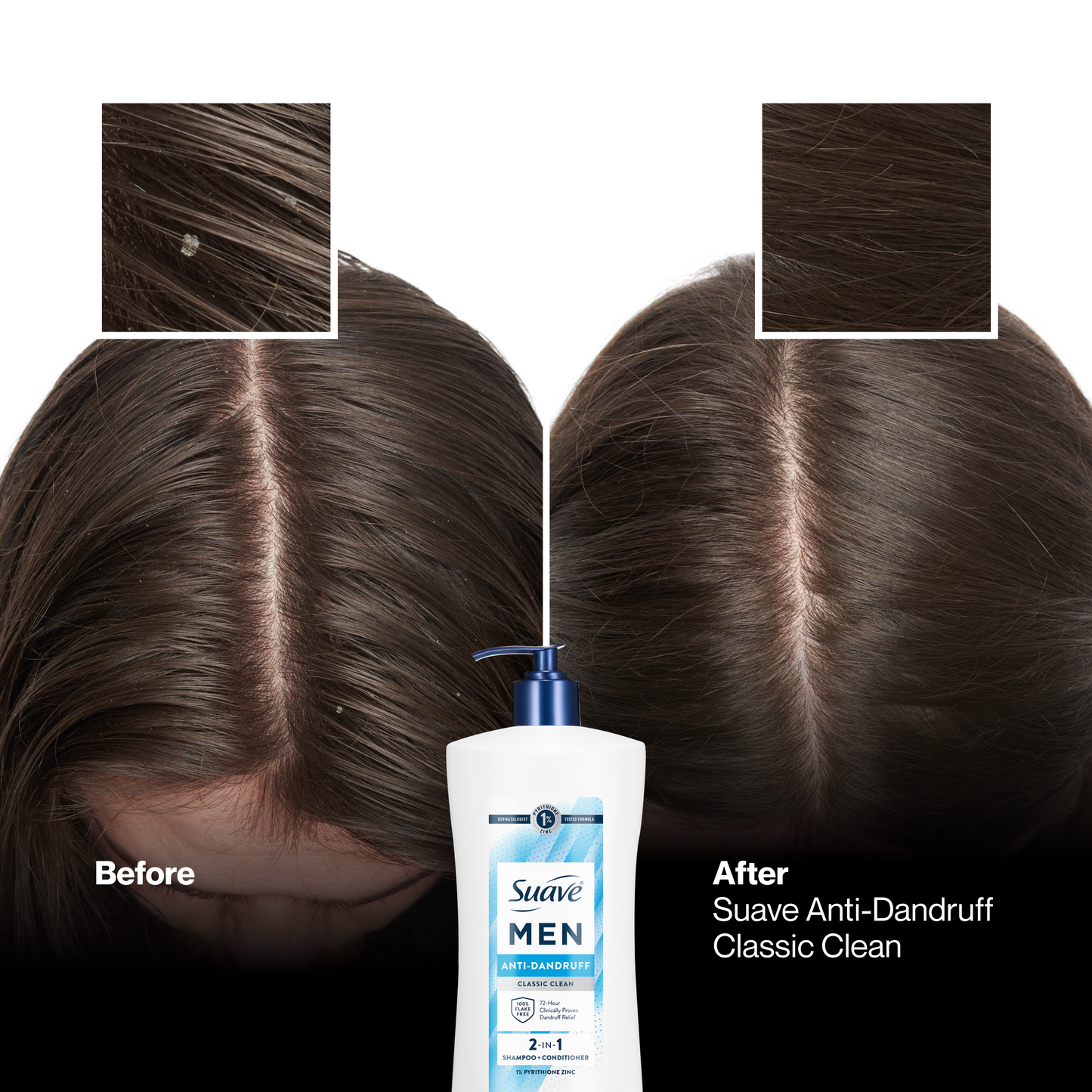 
                  
                    Suave Men 2 IN 1 Anti Dandruff Shampoo & Conditioner, Classic Clean, 72-HR Flake Control, 1% Pyrithione Zinc, Relieves Itchy & Dry Scalp, 28 FL OZ
                  
                