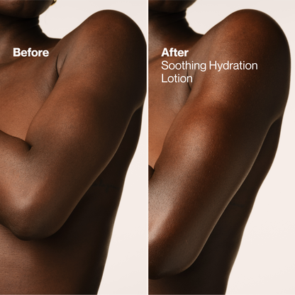 Soothing Hydration Hand & Body Lotion