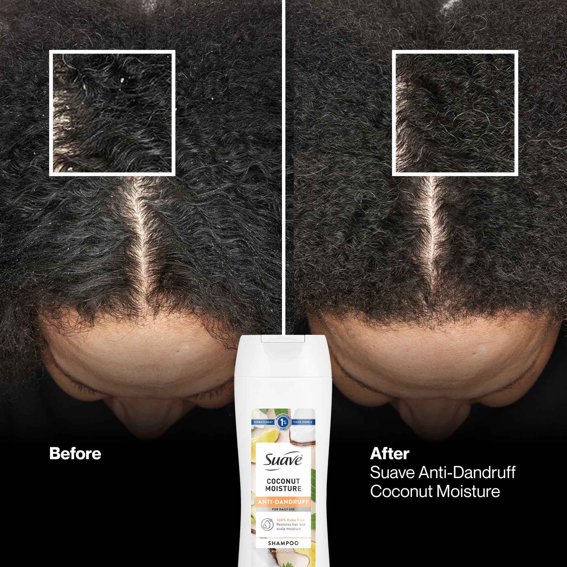 Suave Anti Dandruff Shampoo For Women, Coconut Moisture, 1% Pyrithione Zinc, Controls Flakes, Itch & Dry Scalp, Restores Moisture to Hair & Scalp, 12.6 FL OZ